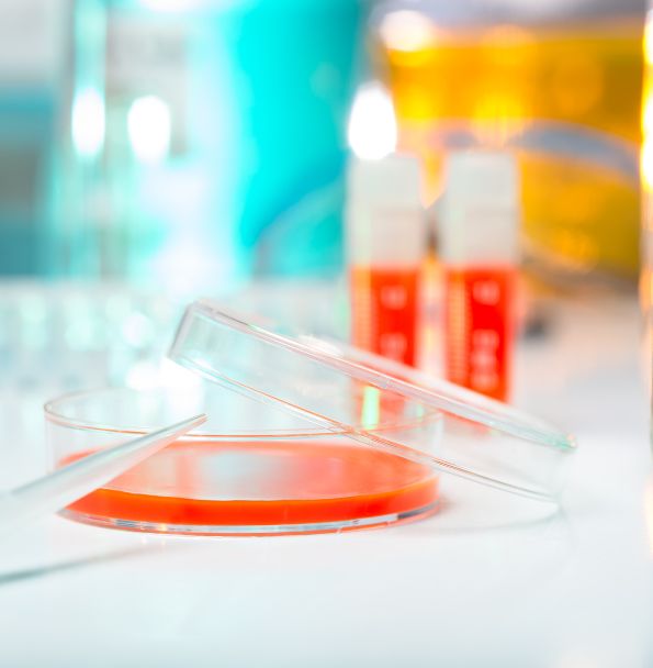 Retiro de Cultivos y Muestras